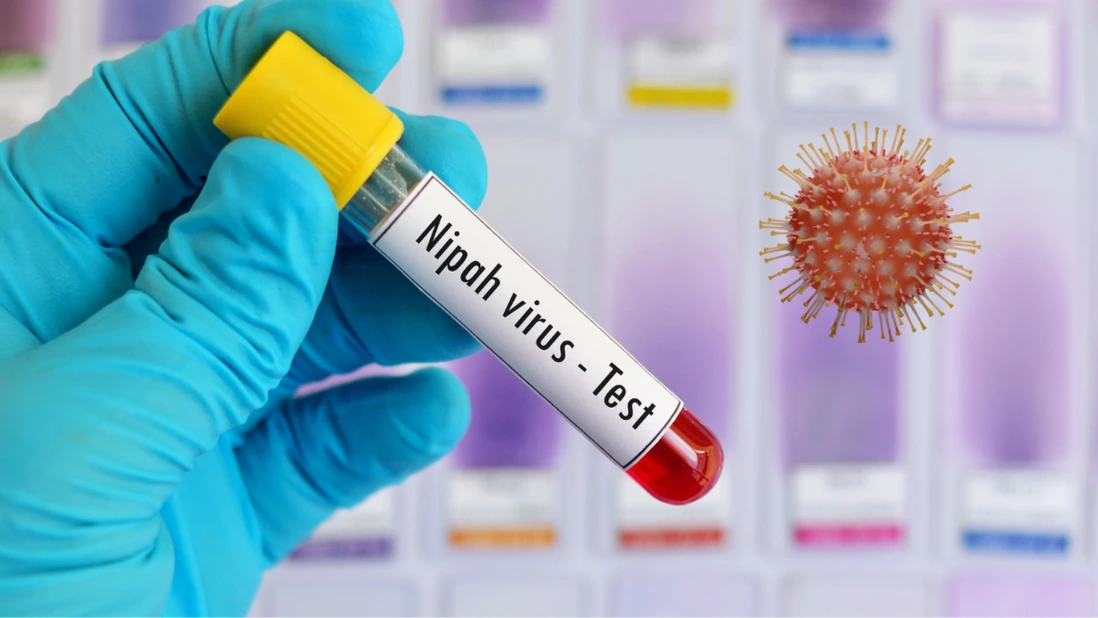 Chủ động nhưng không hoang mang trong phòng bệnh do virus Nipah