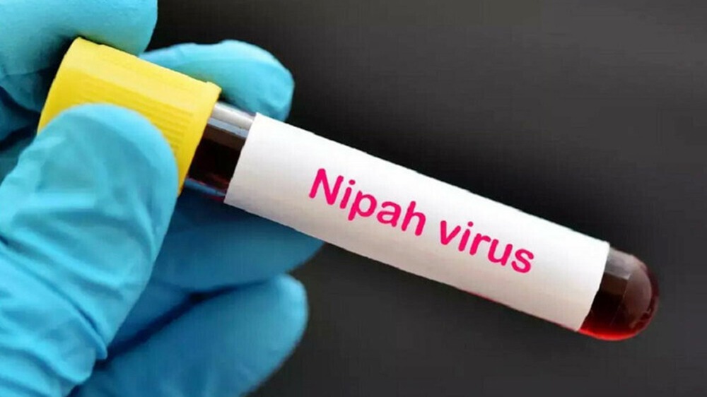 Bộ Y tế ban hành hướng dẫn phòng, chống virus Nipah