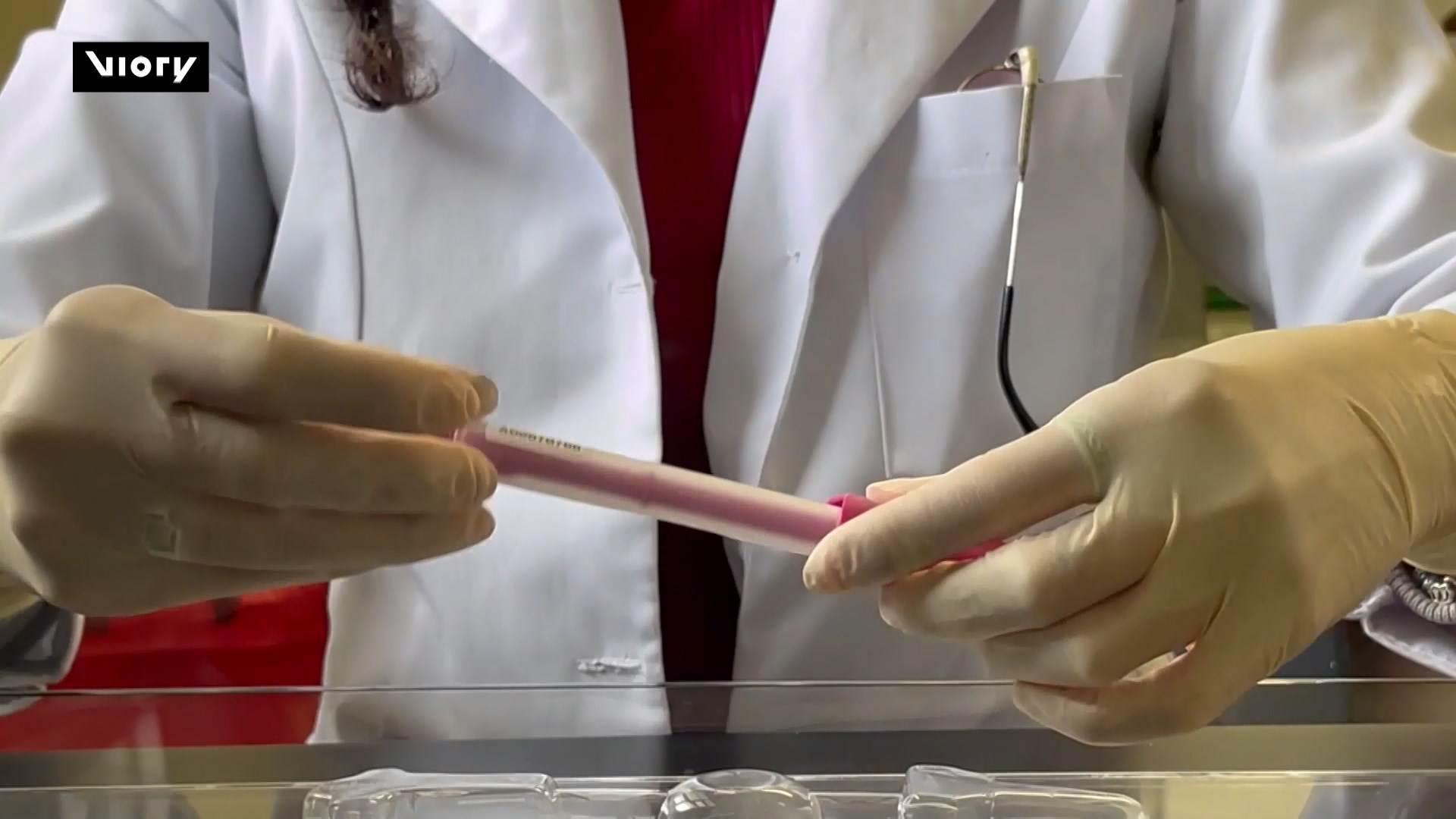 Mexico: Xét nghiệm HPV nhanh giúp ngăn ung thư cổ tử cung