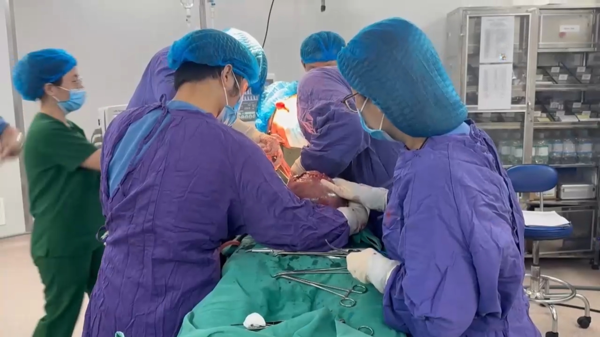 Phẫu thuật cắt bỏ thành công khối u tử cung nặng gần 9kg