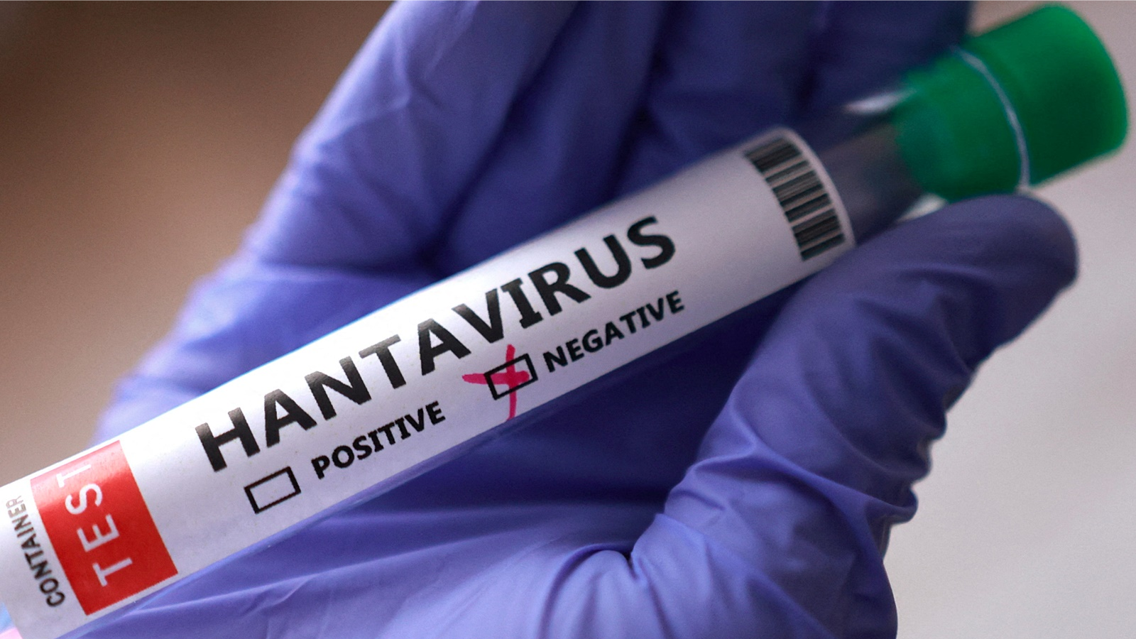 Canada xác nhận ca bệnh đầu tiên nhiễm virus Hanta