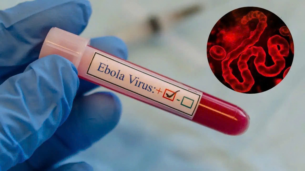WHO công bố kế hoạch gần 320 triệu USD ứng phó dịch Ebola