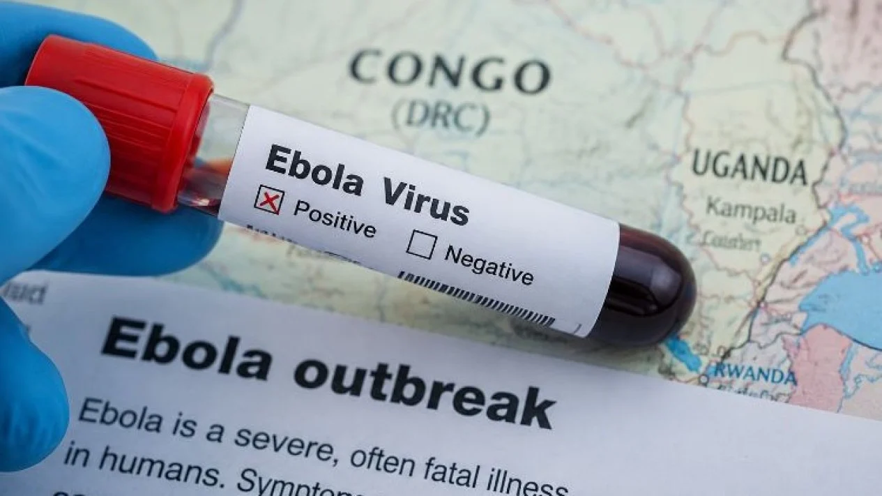 Vaccine Ebola có thể được đưa vào thử nghiệm trong ba tháng tới