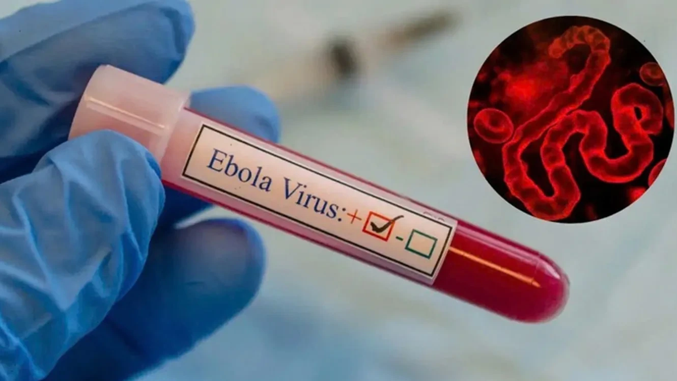 WHO kêu gọi giám sát Ebola toàn cầu
