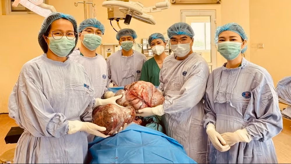 Bệnh viện K phẫu thuật thành công u buồng trứng gần 15kg
