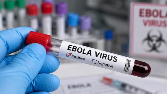 Chạy đua phát triển vaccine ngăn chặn Ebola chủng hiếm tại châu Phi