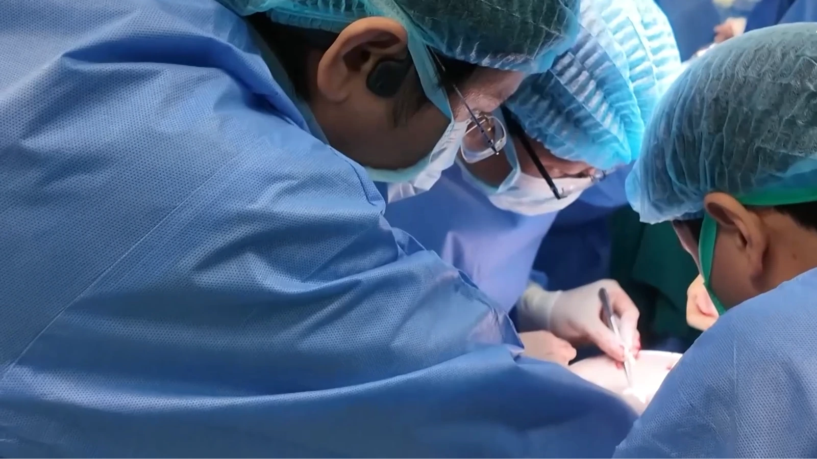 Tật khúc xạ và những biến chứng khó lường | Sức khỏe cộng đồng | 16/08/2026