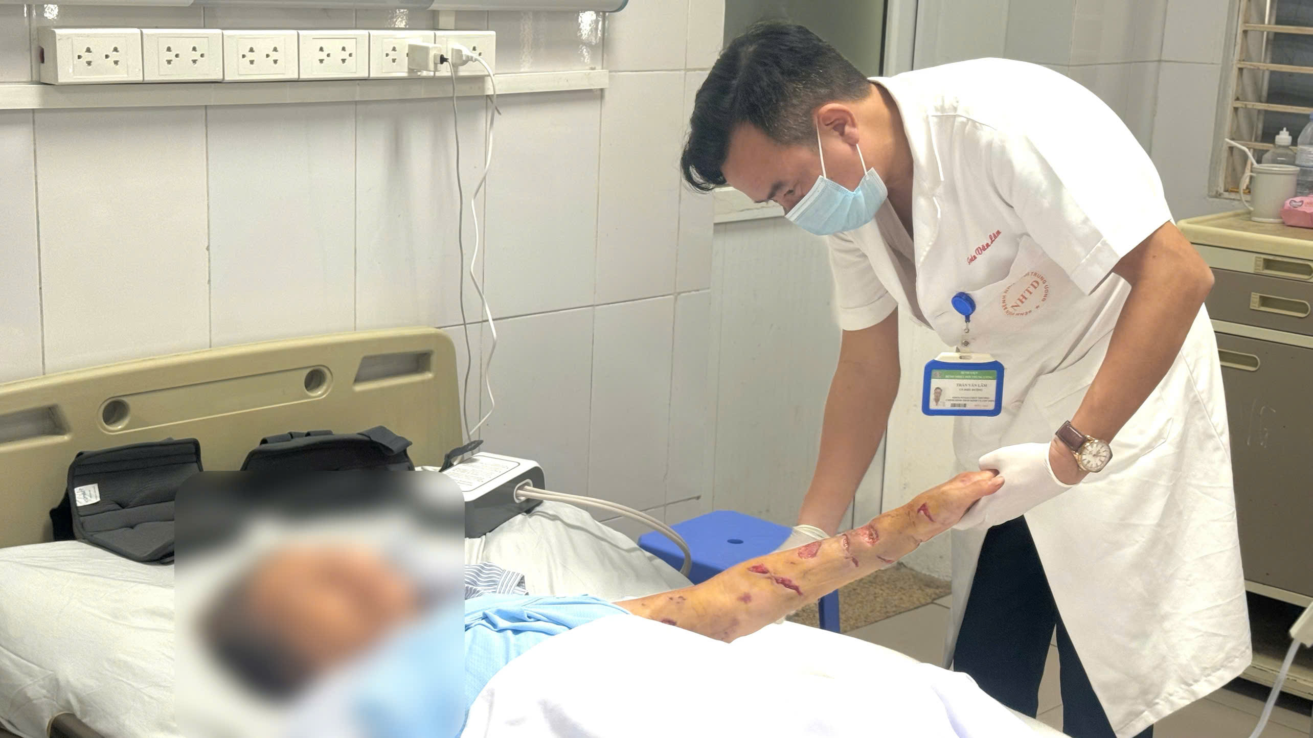 Người cao tuổi cần cảnh giác tổn thương nặng do chó cắn