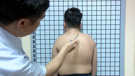 Công nghệ cao trong điều trị bệnh cột sống