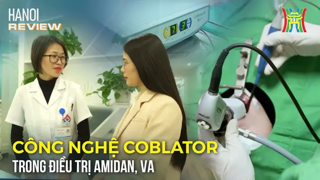 Công nghệ Coblator trong điều trị Amidan, VA cho trẻ | HANOI Review | 17/03/2025