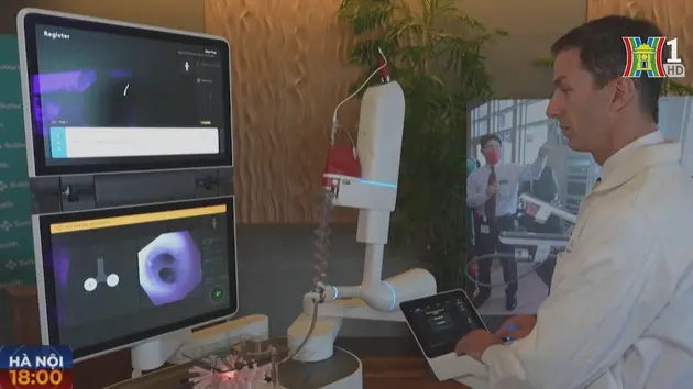 Robot chẩn đoán ung thư phổi