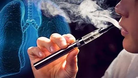 Bé trai 15 tuổi ngộ độc vì thuốc lá điện tử 