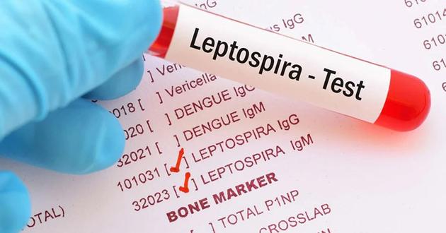 Cách phòng tránh và điều trị bệnh nhiễm xoắn khuẩn Leptospira