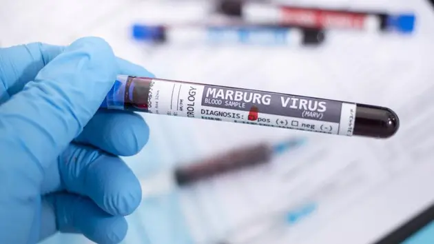 Nga, Kazakhstan tăng cường biện pháp ngăn virus Marburg xâm nhập