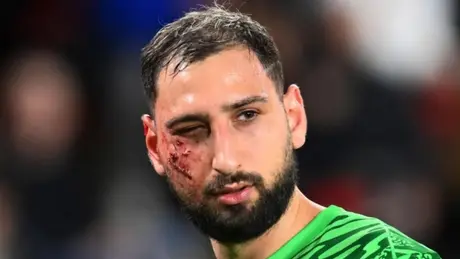 Donnarumma suýt bị mù sau cú đạp kinh hoàng