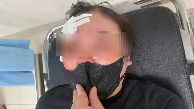 Xác minh vụ tài xế vụt dùi cui vào người đi đường
