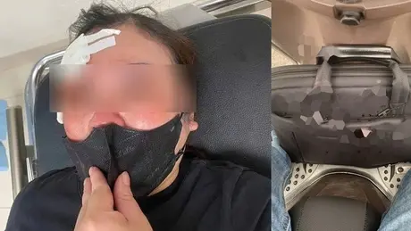 Báo động nạn giải quyết va chạm giao thông bằng bạo lực