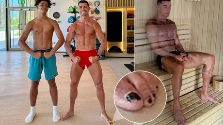 Cristiano Ronaldo sơn móng chân