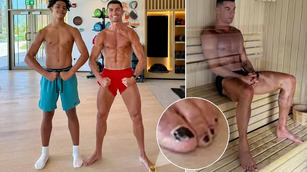 Cristiano Ronaldo sơn móng chân